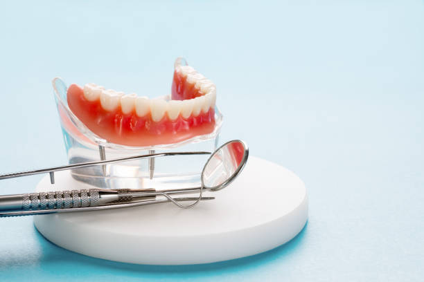 Best Dental Fillings (Composite and Amalgam)  in USA